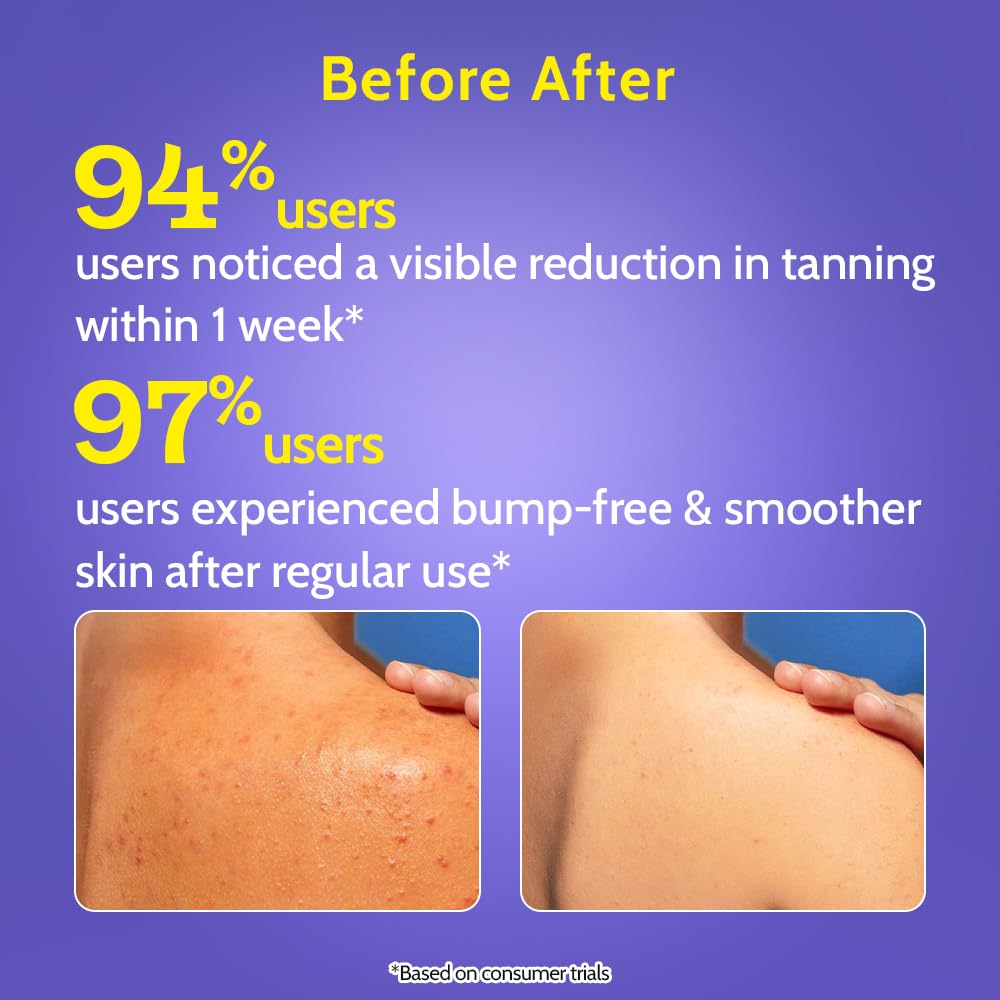 Chemist At Play Body Wash Exfoliating For Dry Rough Bumpy Strawberry Skin With 1% Salicylic Acid 2% Lactic Acid And Ceramides For Men And Women 15.9 Fl oz