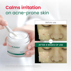 Dr. G R.E.D. Blemish Clear Soothing Cream - Calming Korean Moisturizer for Redness - Soothes Acne & Irritation - With Centella Asiatica - Long-Lasting Hydration - 2.36 fl oz