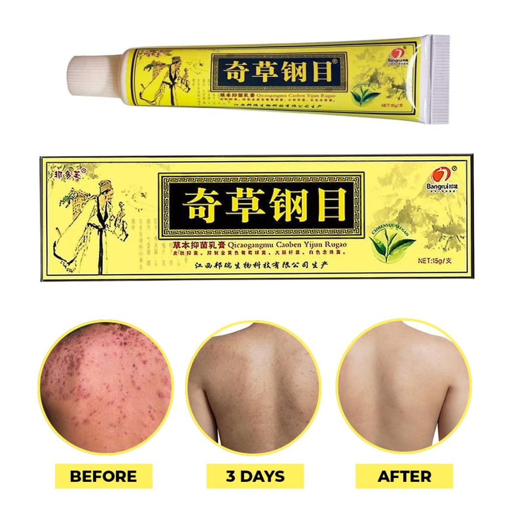 QICAOGANGMU Official Seller - Chinese Herbal Cream - Natural Relief for Skin Issues - Pack of 5
