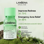 LANBENA Precision Acne Spot Serum, Acne Drying Lotion, Overnight Acne Treatment For Face, Dry Out Pimples, Blemishes, Zits And Clean Pores, 1 Fl Oz