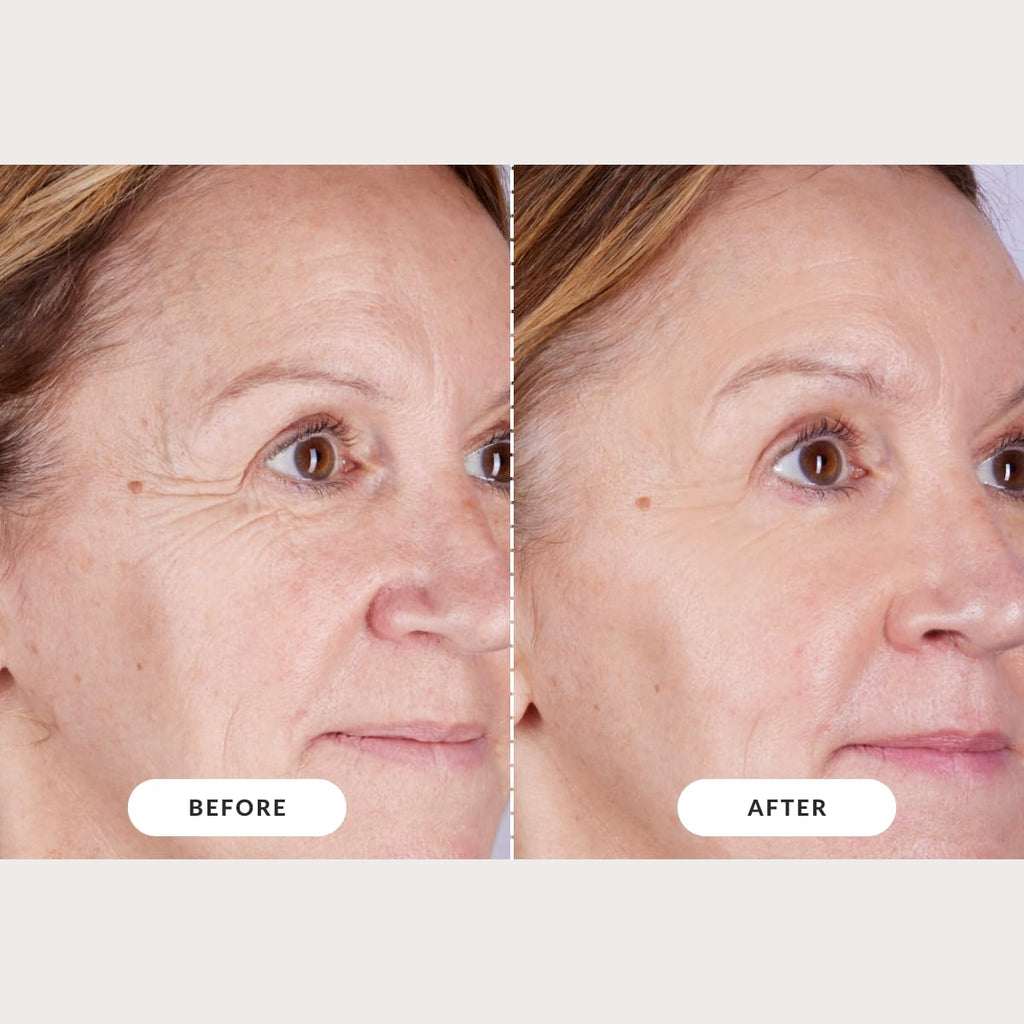 CurrentBody Skin LED Light Therapy Mask: Series 2