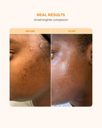 Buttah Skin Vitamin C Serum 1 FL oz e 30mL - For Face - Vitamin E - Ferulic Acid - Green Tea
