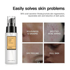 Snail Mucin Serum, Snail Secretion Filtrate, Snail Mucin, Power Repairing Essence