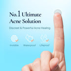 DERMAKR Discreet Acne Pimple Patch | Spot Cover & Treatment Solution Cystic Acne & Pimple | Hydrocolloid Facial Stickers | Waterproof Patches Invisibly Cover Pimples (4packs)