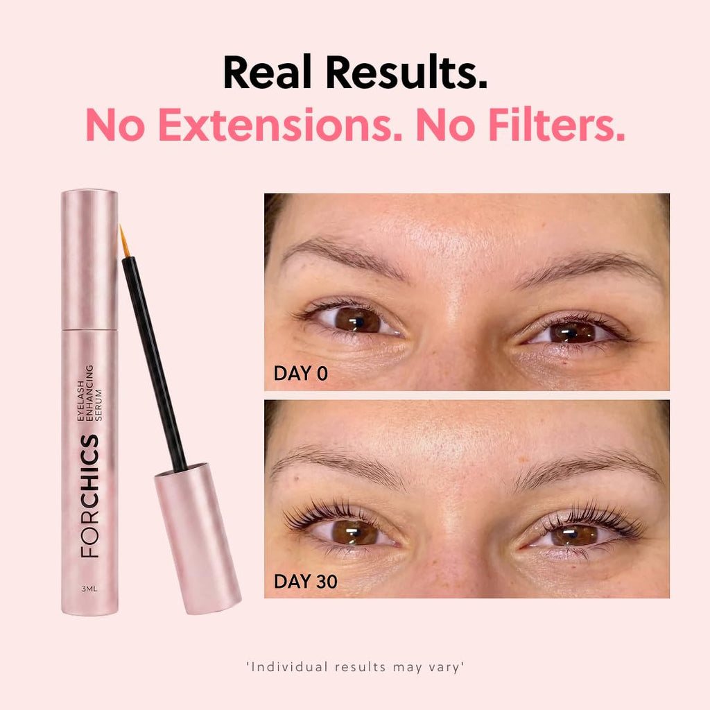 ForChics Prostaglandin-Free Eyelash Growth Serum – Rebuilds Thin Lashes