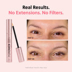 ForChics Prostaglandin-Free Eyelash Growth Serum – Rebuilds Thin Lashes