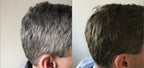 GR-7 Lotion for Grey Hair 125ml - 2 Pcs - Anti Grey Hair for Men and Women - Against Grey Hair - Away with Grey Hair