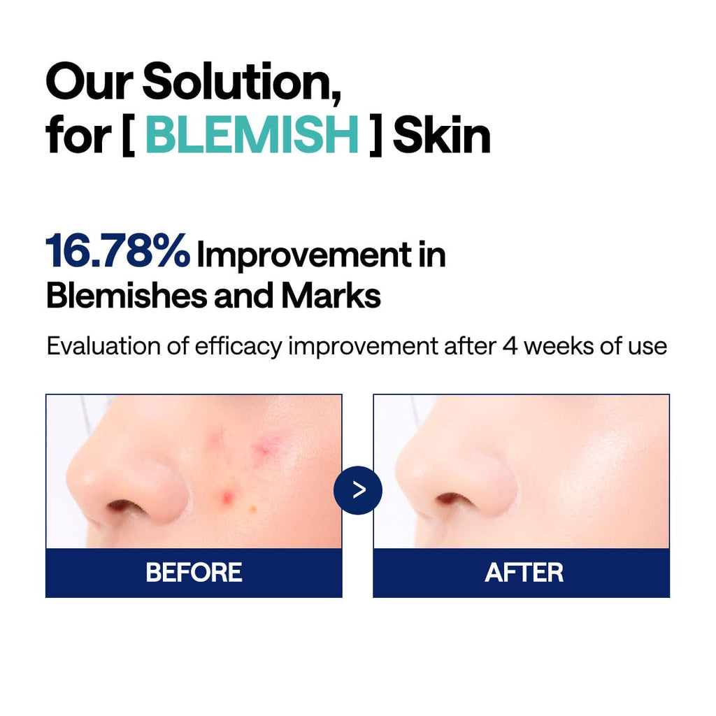 MEDIHEAL Madecassoside Blemish Pad - Square Cotton Facial Toner Pads with Centella Asiatica & Madecassoside – Anti Blemish to Improve Uneven Skin Tone - Vegan Face Gauze Pads, 100