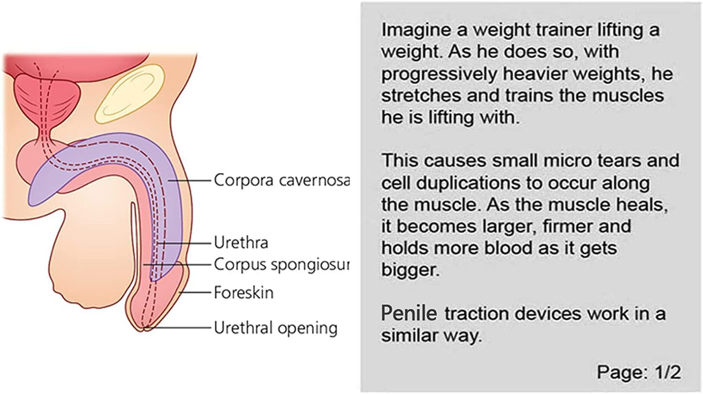 Penile Traction Devices for Men Massage Kit Massage Men's Bracket Kit Physical Increase Size