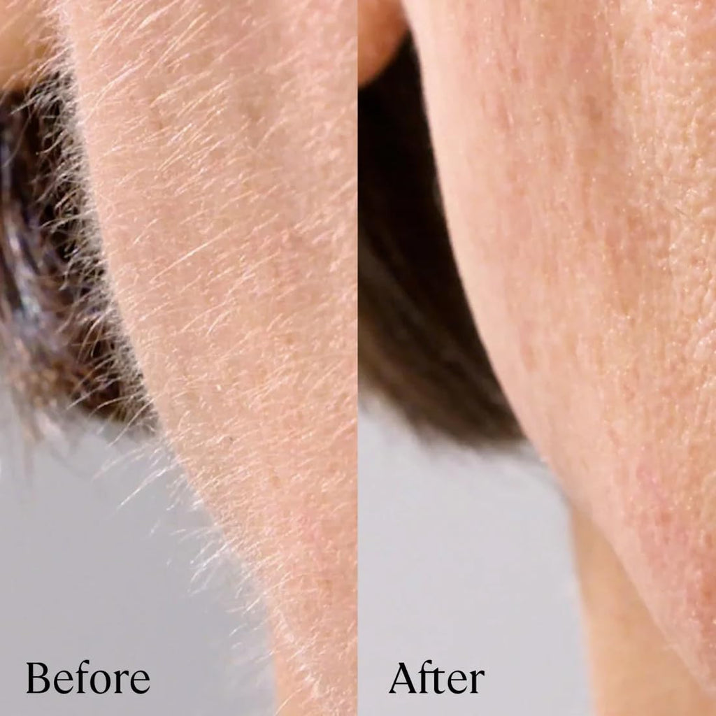 Michael Todd Beauty - Sonicsmooth Pro+ Dermaplaning Blade Refills - 8 Dermaplaning Blades- 2 Month Supply - Device Not Included