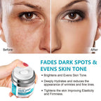 Dark Spot Remover for Face, Fast-Acting Dark Spot Corrector Remover for Face and body Hyperpigmentation, Fades Melasma, Freckle, Sun Spots, Evens Skin Tone, Age Spot Remover for Women Men