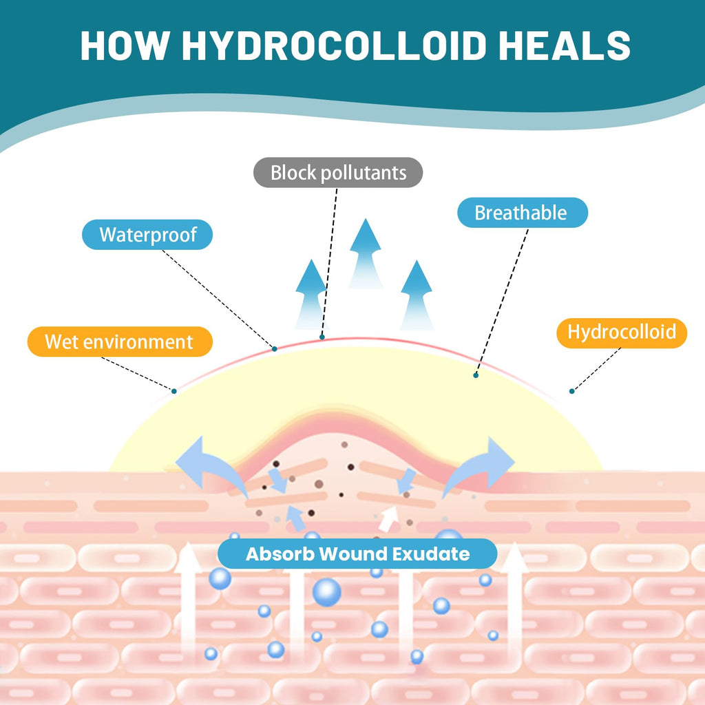 CUKWUYBY Hydrocolloid Roll for Wound Care, 2in*6.6ft Hydrocolloid Bandages