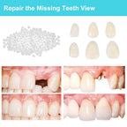 Brige Temporary Tooth Repair Missing Tooth- Moldable Fake Teeth Artfifical Teeth,Cosmetic Tooth Replacement Kit for Teeth Veneers