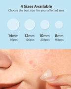 LitBear Acne Pimple Patches- Day and Night 4 Sizes 588 Dots Thin & Thick Hydrocolloid Patches with Witch Hazel, Tea Tree & Calendula Oil, Extra Adhesion for Face Zit Patch Dots