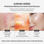 [CHALLANS de PARIS] Ampoule d’Aurora Excellence – Soothing & Balancing Skin-Barrier Support Serum with Niacinamide, Oligo-HA & Ceramide | Lightweight Watery, Hydrating Korean Skincare, 1.23 fl oz