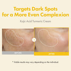 TOSOWOONG Kojic Acid Turmeric Cream, 99% Purity Kojic Acid 7,000ppm, 660,941ppm Turmeric, Dark Spot Corrector Capsule for Hyperpigmentation & Even Skin Tone Care, Korean Skincare, 50ml / 1.69 fl. oz.