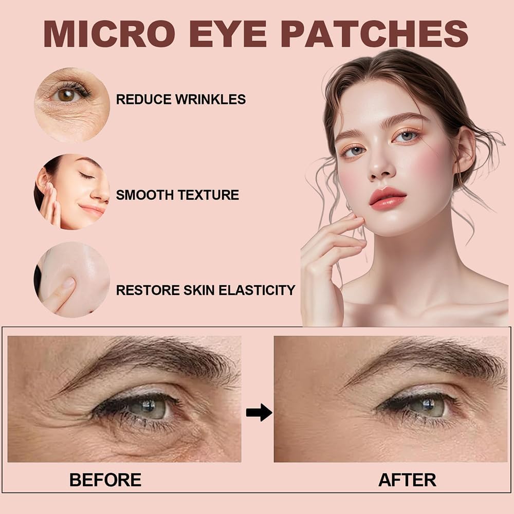 NOVALIFT Micro Eye Patches – Under Eye Patchs Smile Line Patches (2BOX(6 Pairs))