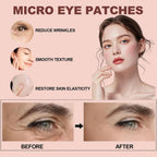 NOVALIFT Micro Eye Patches – Under Eye Patchs Smile Line Patches (2BOX(6 Pairs))