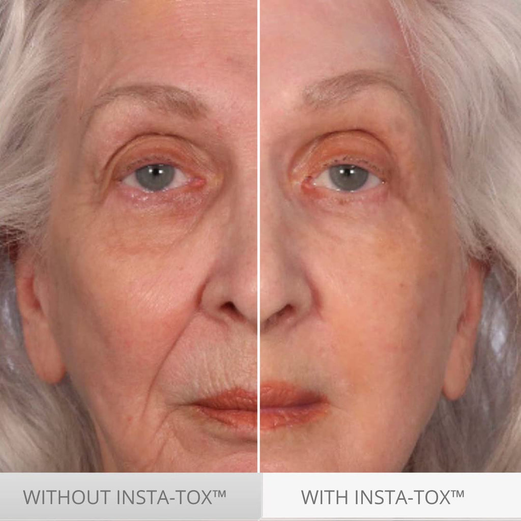 Serious Skincare - IMPROVES the appearance of deep wrinkles, fine lines, under eye bags, crow's feet, forehead and upper eyelid lines.
