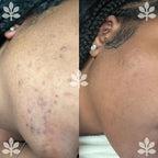 Bellurelle - The Goat Face & Body Bar - Fades hyperpigmentation, Nourishes, Brightens for All Skin Types