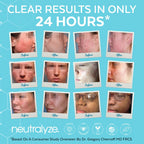 Neutralyze Exfoliating Acne Treatment Wipes - Maximum Strength, Textured Acne Pads with Mandelic Acid & Salicylic Acid for Face & Body - Suitable for All Skin Types, Teens & Adults (100 Wipes)