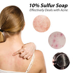 Bee & Flower Shanghai Sulfur Soap 10% Sulfur Soap Bar Face and Body Acne Treatment Sulphur Bar Soaps 3.4 Oz (6 Packs)