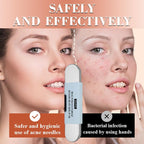 Medical Grade Blackhead Extraction Tool Kit - Blackhead Remover Tool Comedones Extractor Acne Removal Kit for Blemish - Whitehead Popping - 7 Pcs Set Removing for Nose Face Tools (Content 7-Piece Set)