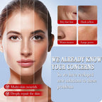 Kojic Acid Cream, Face and Body Gel, Dark Spots, Melasma, Natural Ingredients, Moisturizing and Mild Effect (2pcs acido kojico)