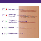 Silicone Scar Gel Scar Cream: SPF 30 Advanced Medical-Grade Formula for Surgical Scars, C-Section, Stretch Marks, Acne, Burns, Keloids, Old & New Scars – Broad Spectrum UV Protection 1.06oz (30g)