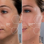 Michael Todd Beauty Sonicsmooth Pro+ Dermaplane Razor Blade Refills - 8 Dermaplaning Blades - 2 Month Supply - Device Not Included