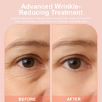 YLOTRE Novalift Micro Eye Patches, Under Eye Patches for Puffy Eyes, Dark Circles & Fine Lines, Deeply Hydrating Anti-Wrinkle Patches, Smooth Application Forehead & Smile Line Patches (2)