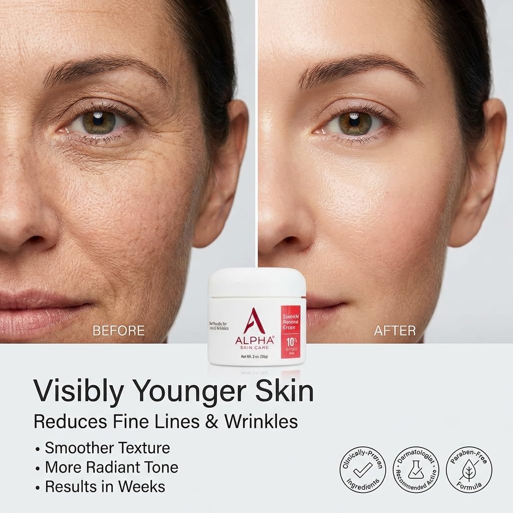 Alpha Skin Care Essential Renewal Cream, 10% Glycolic AHA, Anti-Aging Formula, Reduces Lines & Wrinkles, Alpha Hydroxy Acid Exfoliates for Smoother Skin, Normal, Sensitive or Dry Skin, 2 Oz