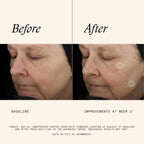 SkinMedica TNS Advanced+ Face Serum (NEW PACKAGING) - Multi Peptide Serum to Help Improve the Appearance of Wrinkles, Fine Lines, Skin Tone & Texture (1 Fl Oz)
