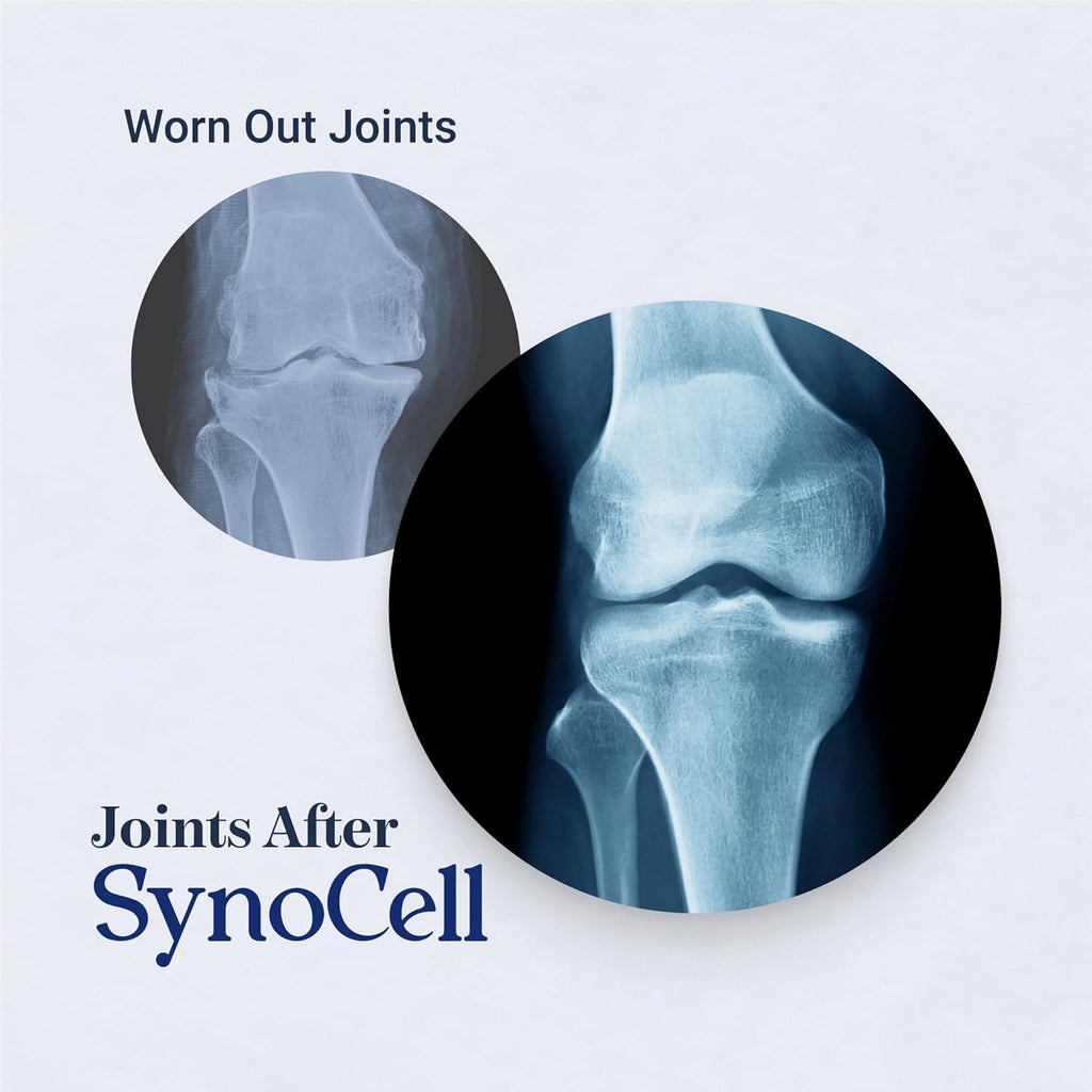 Synocell Glucosamine Chondroitin Complex 4 Pack Back, Neck, and Joint Support Supplement with Boswellia, Quercetin, & MSM - Renew Your Joints from The Inside Out - Move with Freedom and Ease
