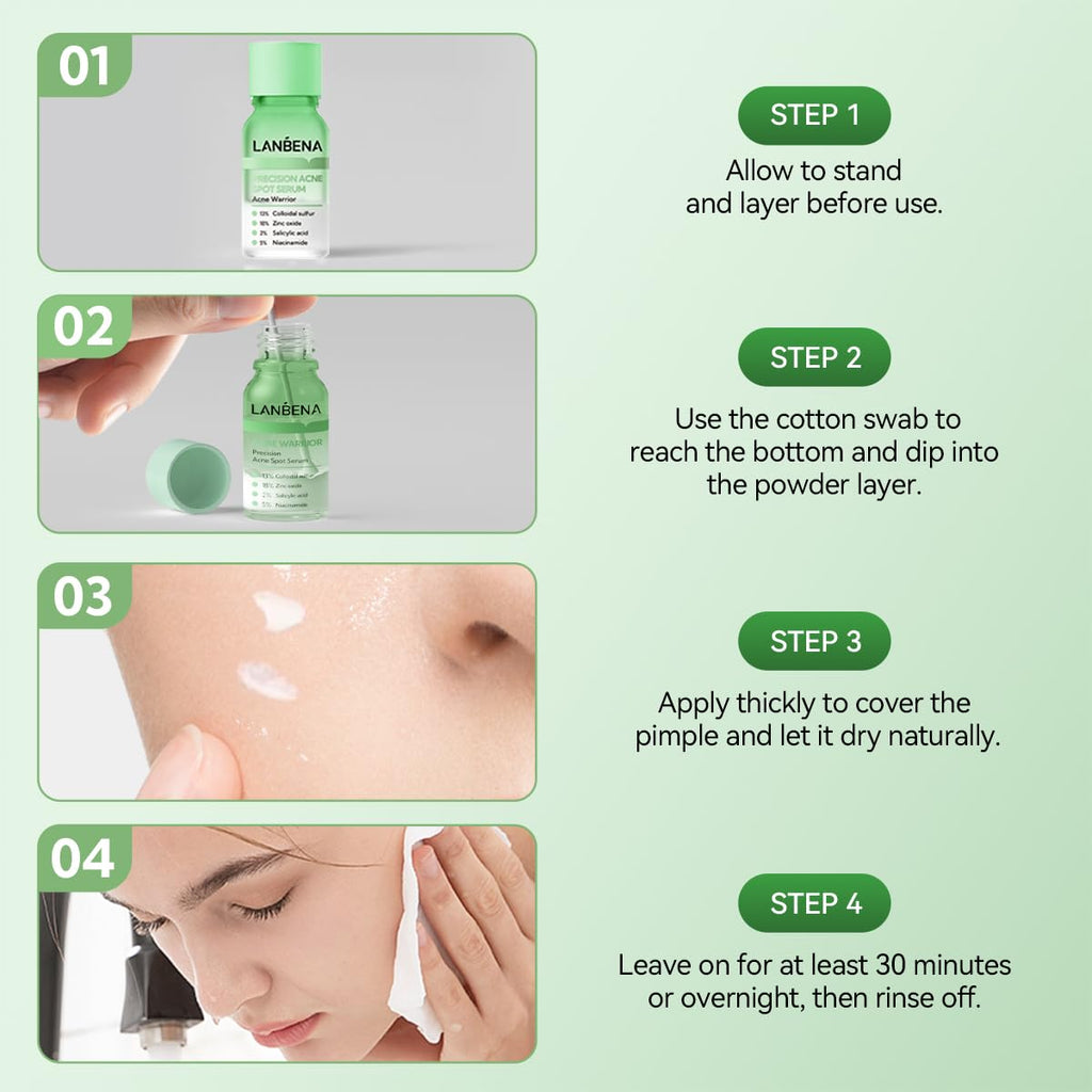 LANBENA Precision Acne Spot Serum, Acne Drying Lotion, Overnight Acne Treatment For Face, Dry Out Pimples, Blemishes, Zits And Clean Pores, 1 Fl Oz