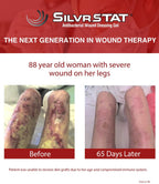 SilvrSTAT First Aid Kit Gel, 32 PPM Silver Healing Wound Dressing Gel, SilverSol Ag₄O₄ Particles, 1 oz