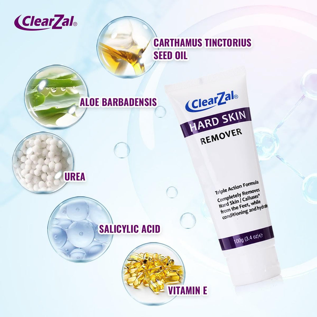 Clearzal Foot Cream For Hard Skin, Helps Calluses and Corn Removal While Leaving Soft Smooth Skin, Hydrating and Conditioning Triple Action Formula With Aloe Vera, 3.4 Ounce Tube