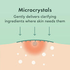 Rael Pimple Patches, Miracle Microcrystal Spot Cover - Hydrocolloid Acne Pimple Patch with Tea Tree Oil, Early Stage Zits and Blemish, Korean Skin Care (18 Count)