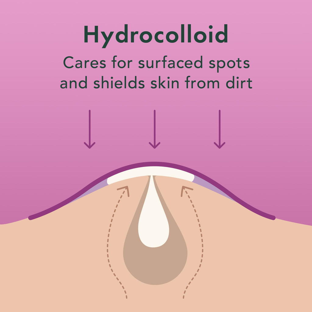 Rael Miracle Overnight Spot Cover Hydrocolloid Acne Pimple Patches (104 Ct)