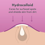 Rael Miracle Overnight Spot Cover Hydrocolloid Acne Pimple Patches (104 Ct)