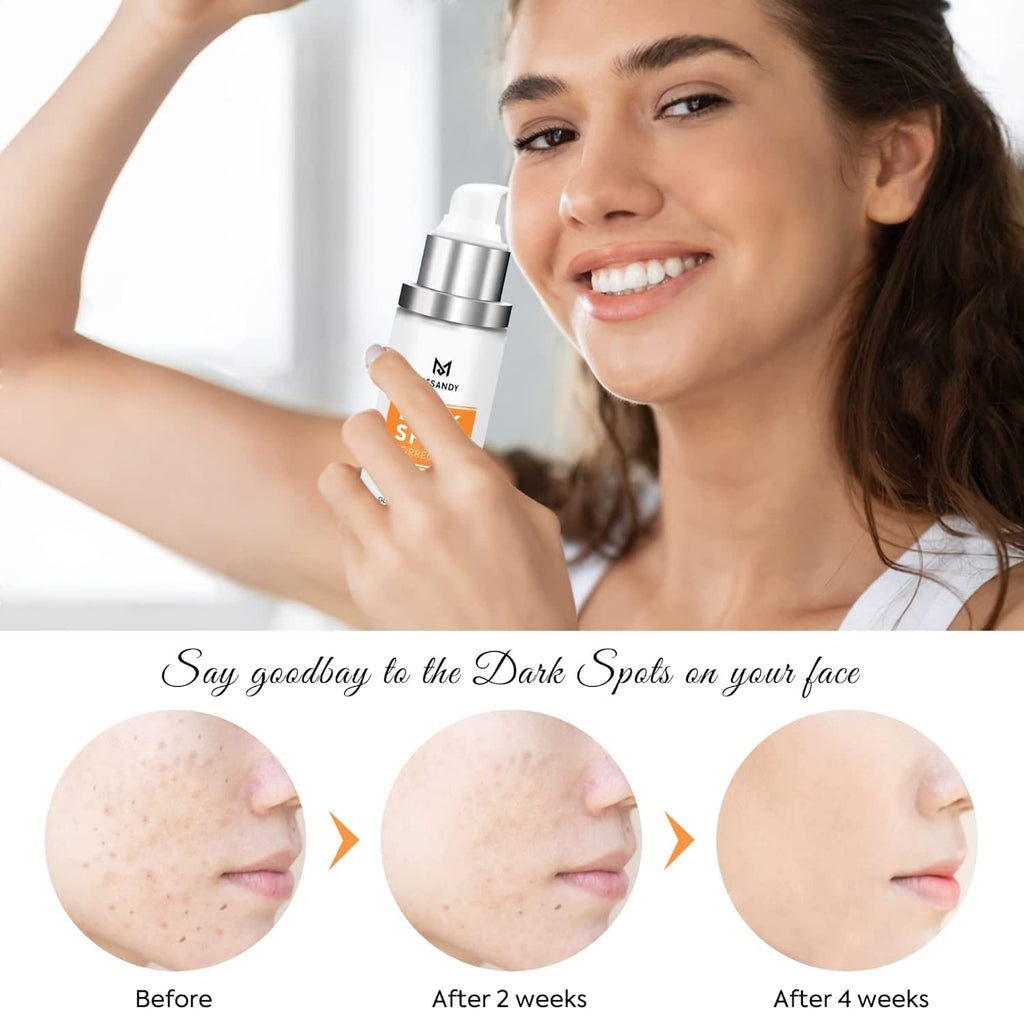 Dark Spot Corrector, Dark Spot Remover For Face and Body Serum | Improves Hyperpigmentation, Facial Freckles, Melasma, Brown Spots