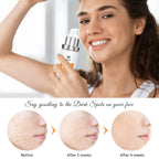Dark Spot Corrector, Dark Spot Remover For Face and Body Serum | Improves Hyperpigmentation, Facial Freckles, Melasma, Brown Spots