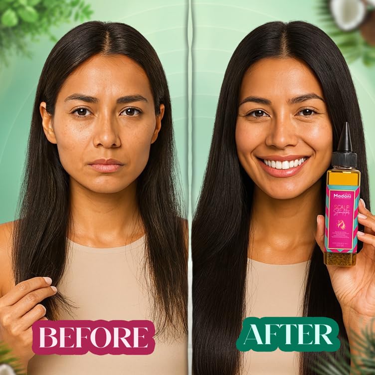 Madani Scalp Stimulator Hair Growth Oil, 4 fl oz, Nourishing Follicle Treatment, Hair Repair Regrowth with Rosemary & Mint