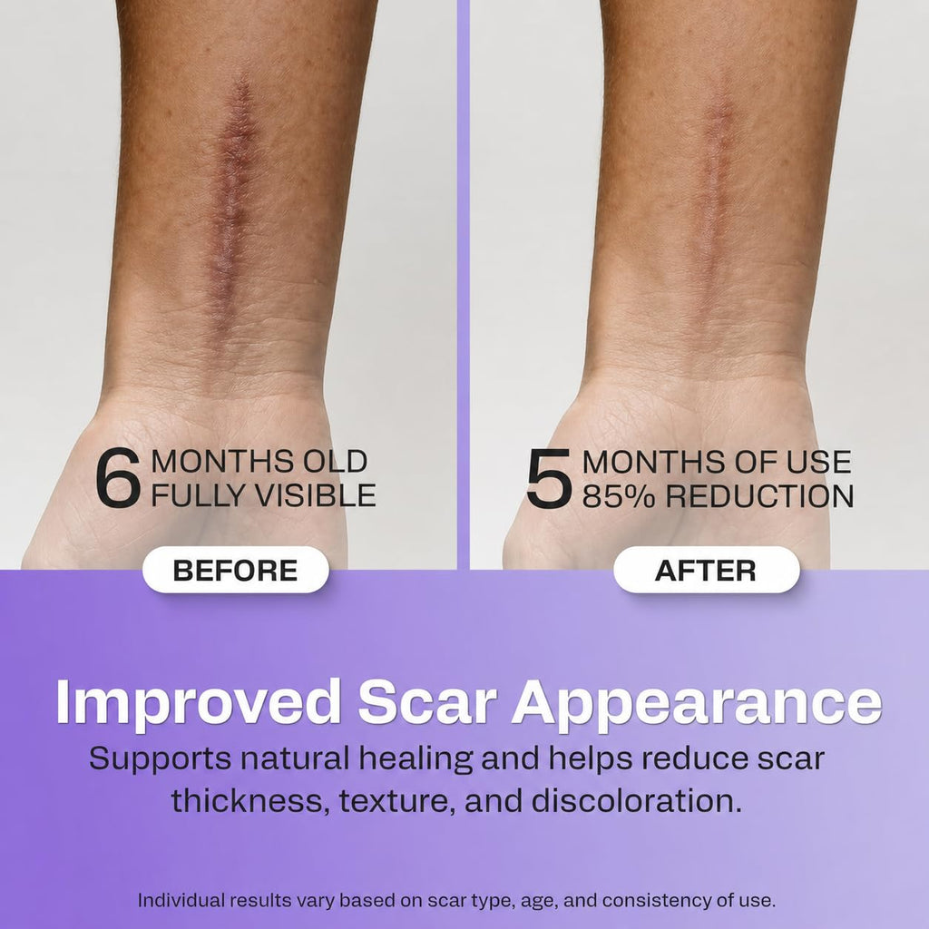 Silicone Scar Tape — Medical-Grade, 1.6" x 60", Cut-to-Fit for C-Section, Surgical & Keloid Scars, Face & Wrinkles | Reusable