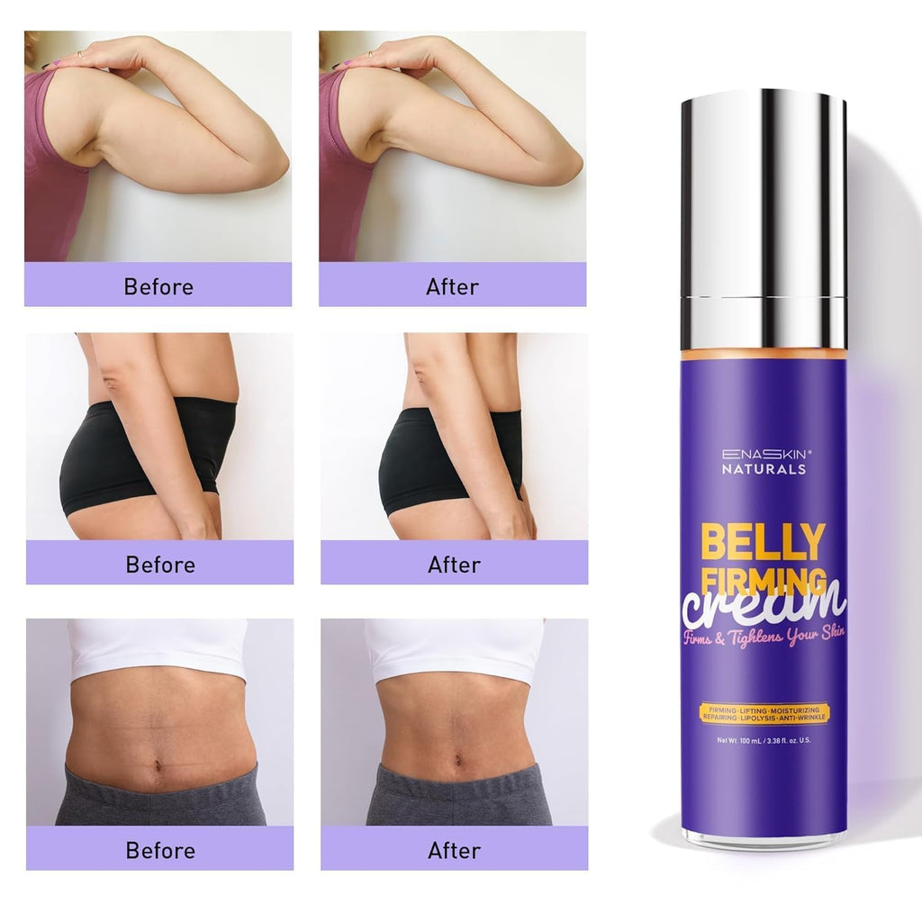 Enaskin Naturals Belly Firming Cream: Hibiscus & Honey Skin Tightening Cellulite Cream - Women Body Lotion for Firmness and Lift of Thighs & Stomach - Tummy Butter Stretch Marks - Purple 120 mL