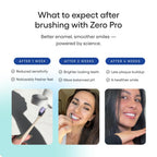 Something Nice Zero Pro Toothpaste - 10% Nano Hydroxyapatite Toothpaste Fluoride Free with BioFuse Oil Matrix, Remineralizing, Whitening and Enamel Repair for Sensitive Teeth, Adults & Kids, Mint, 4oz