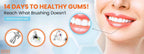 Oral Breeze ShowerBreeze | Oral Irrigator & Water Pick Teeth Cleaner for Braces, Gums, Implants | Shower-Powered, No Batteries, No Mess | Adjustable Pressure & Unlimited Warm Water