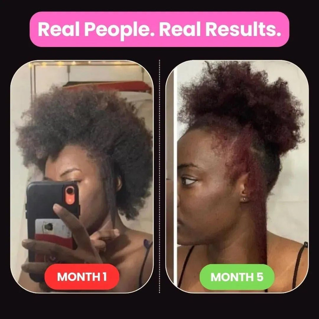 10 in 1 Hair Growth Oil (2 Oz) | Formulated With African Chebe Powder For Extreme Hair Growth, 2 Fl Oz (Pack of 1)