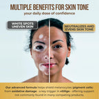 Dermawonder Vitiligo Capsules (60 Count) Effective Vitiligo Supplement, Reduce White Spots & Improve Skin Pigmentation Support, for All Skin & Reduce White Spots on Skin and Tinted Skin
