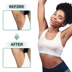 Skin Bleaching Cream Skin Lightening for Body Intimate Areas, Private Parts, Underarm, Knees, Elbows, Inner Thigh, Bikini Area, Whitening Cream Dark Spot Remover For Intimate Areas (1.7FL OZ)